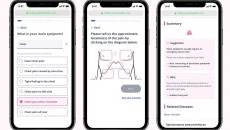 Mobile interface of Ubie's web-based AI Symptom Checker